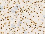 Phospho-RSK Pan (Ser221, Ser227, Ser218, Ser232) Antibody in Immunohistochemistry (Paraffin) (IHC (P))