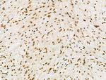 Phospho-RSK Pan (Ser221, Ser227, Ser218, Ser232) Antibody in Immunohistochemistry (Paraffin) (IHC (P))