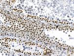 Phospho-RSK Pan (Ser221, Ser227, Ser218, Ser232) Antibody in Immunohistochemistry (Paraffin) (IHC (P))