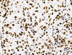 Phospho-RSK Pan (Ser221, Ser227, Ser218, Ser232) Antibody in Immunohistochemistry (Paraffin) (IHC (P))