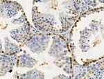 Phospho-SAMHD1 (Thr592) Antibody in Immunohistochemistry (Paraffin) (IHC (P))