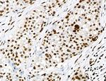 Phospho-SMAD5 (Ser463, Ser465) Antibody in Immunohistochemistry (Paraffin) (IHC (P))