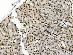 Phospho-SMAD5 (Ser463, Ser465) Antibody in Immunohistochemistry (Paraffin) (IHC (P))