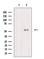 Phospho-SMAD5 (Ser463, Ser465) Antibody in Western Blot (WB)