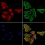 Phospho-SNAIL (Ser11) Antibody in Immunocytochemistry (ICC/IF)