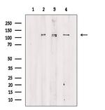 Phospho-TAOK2 (Ser181) Antibody in Western Blot (WB)