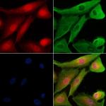 Phospho-TAOK2 (Ser181) Antibody in Immunocytochemistry (ICC/IF)