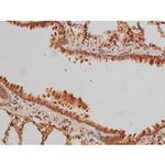 Phospho-Tau (Ser579) Antibody in Immunohistochemistry (Paraffin) (IHC (P))