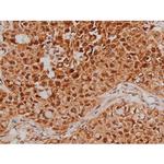 Phospho-Tau (Ser579) Antibody in Immunohistochemistry (Paraffin) (IHC (P))