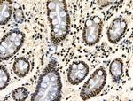 Phospho-TDP-43 (Ser409, Ser410) Antibody in Immunohistochemistry (Paraffin) (IHC (P))