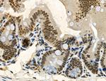 Phospho-TDP-43 (Ser409, Ser410) Antibody in Immunohistochemistry (Paraffin) (IHC (P))