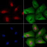 Phospho-TFEB (Ser211) Antibody in Immunocytochemistry (ICC/IF)