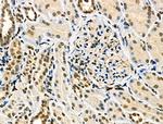 Phospho-TFEB (Ser211) Antibody in Immunohistochemistry (Paraffin) (IHC (P))