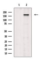 Phospho-VEGF Receptor 1 (Tyr1333) Antibody in Western Blot (WB)