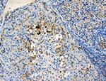 Phospho-Vimentin (Ser39) Antibody in Immunohistochemistry (Paraffin) (IHC (P))