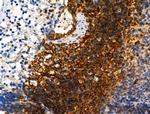 Phospho-ZO-2 (Tyr1118) Antibody in Immunohistochemistry (Paraffin) (IHC (P))