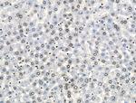 H2A.Zac pan-acetyl (K4,K7,K11,K13) Antibody in Immunohistochemistry (Paraffin) (IHC (P))