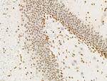 H2A.Zac pan-acetyl (K4,K7,K11,K13) Antibody in Immunohistochemistry (Paraffin) (IHC (P))