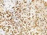 H2A.Zac pan-acetyl (K4,K7,K11,K13) Antibody in Immunohistochemistry (Paraffin) (IHC (P))