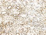 H2A.Zac pan-acetyl (K4,K7,K11,K13) Antibody in Immunohistochemistry (Paraffin) (IHC (P))