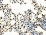 H2A.Zac pan-acetyl (K4,K7,K11,K13) Antibody in Immunohistochemistry (Paraffin) (IHC (P))