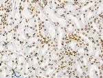 H2A.Zac pan-acetyl (K4,K7,K11,K13) Antibody in Immunohistochemistry (Paraffin) (IHC (P))