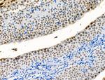 H2A.Zac pan-acetyl (K4,K7,K11,K13) Antibody in Immunohistochemistry (Paraffin) (IHC (P))