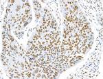 H2BK5ac Antibody in Immunohistochemistry (Paraffin) (IHC (P))