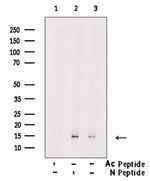 H2BK5ac Antibody in Western Blot (WB)