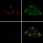 H2BK20ac Antibody in Immunocytochemistry (ICC/IF)