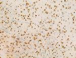 H2BK20ac Antibody in Immunohistochemistry (Paraffin) (IHC (P))