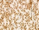 H2BK20ac Antibody in Immunohistochemistry (Paraffin) (IHC (P))