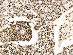 H2BK20ac Antibody in Immunohistochemistry (Paraffin) (IHC (P))