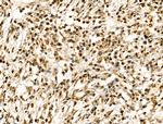 H2BK20ac Antibody in Immunohistochemistry (Paraffin) (IHC (P))