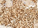 H2BK20ac Antibody in Immunohistochemistry (Paraffin) (IHC (P))