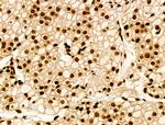 H2BK20ac Antibody in Immunohistochemistry (Paraffin) (IHC (P))