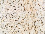 H2BK20ac Antibody in Immunohistochemistry (Paraffin) (IHC (P))