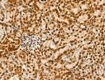 H2BK20ac Antibody in Immunohistochemistry (Paraffin) (IHC (P))