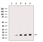 H2BK20ac Antibody in Western Blot (WB)