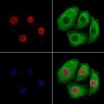 Histone H3ac (pan-acetyl) Antibody in Immunocytochemistry (ICC/IF)