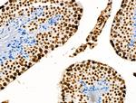 Histone H3ac (pan-acetyl) Antibody in Immunohistochemistry (Paraffin) (IHC (P))