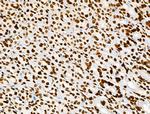 Histone H3ac (pan-acetyl) Antibody in Immunohistochemistry (Paraffin) (IHC (P))