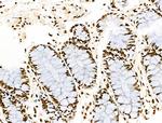 Histone H3ac (pan-acetyl) Antibody in Immunohistochemistry (Paraffin) (IHC (P))