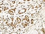 Histone H3ac (pan-acetyl) Antibody in Immunohistochemistry (Paraffin) (IHC (P))