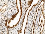 Histone H3ac (pan-acetyl) Antibody in Immunohistochemistry (Paraffin) (IHC (P))