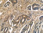 Acetyl-SOD2 (Lys68) Antibody in Immunohistochemistry (Paraffin) (IHC (P))