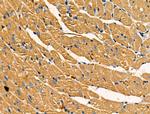 Acetyl-SOD2 (Lys68) Antibody in Immunohistochemistry (Paraffin) (IHC (P))