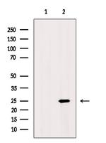 Acetyl-SOD2 (Lys68) Antibody in Western Blot (WB)