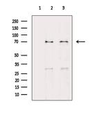 E2F1 Antibody in Western Blot (WB)