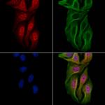 AEBP1 Antibody in Immunocytochemistry (ICC/IF)